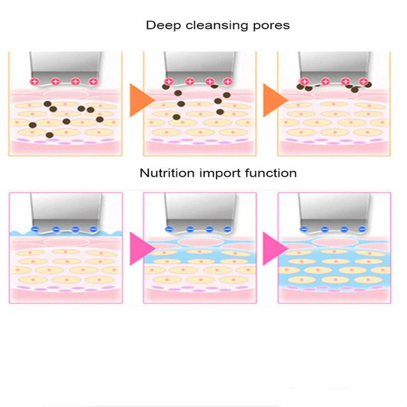 ULTRASONIC SKIN SCRUBBER (BT Micro)