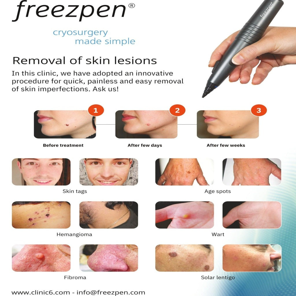 FREEZPEN - DEMO DEVICE